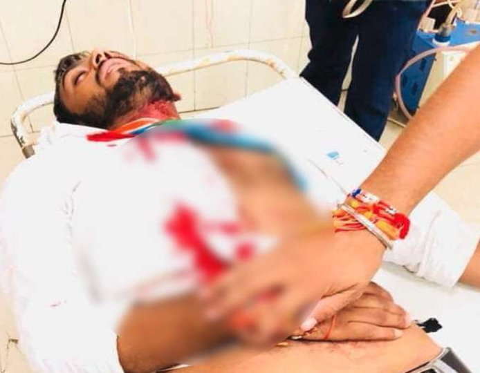 एनएसयूआई के प्रत्याशी और अध्यक्ष को अज्ञात लोगों ने पीटा, दोनों अस्पताल में भर्ती